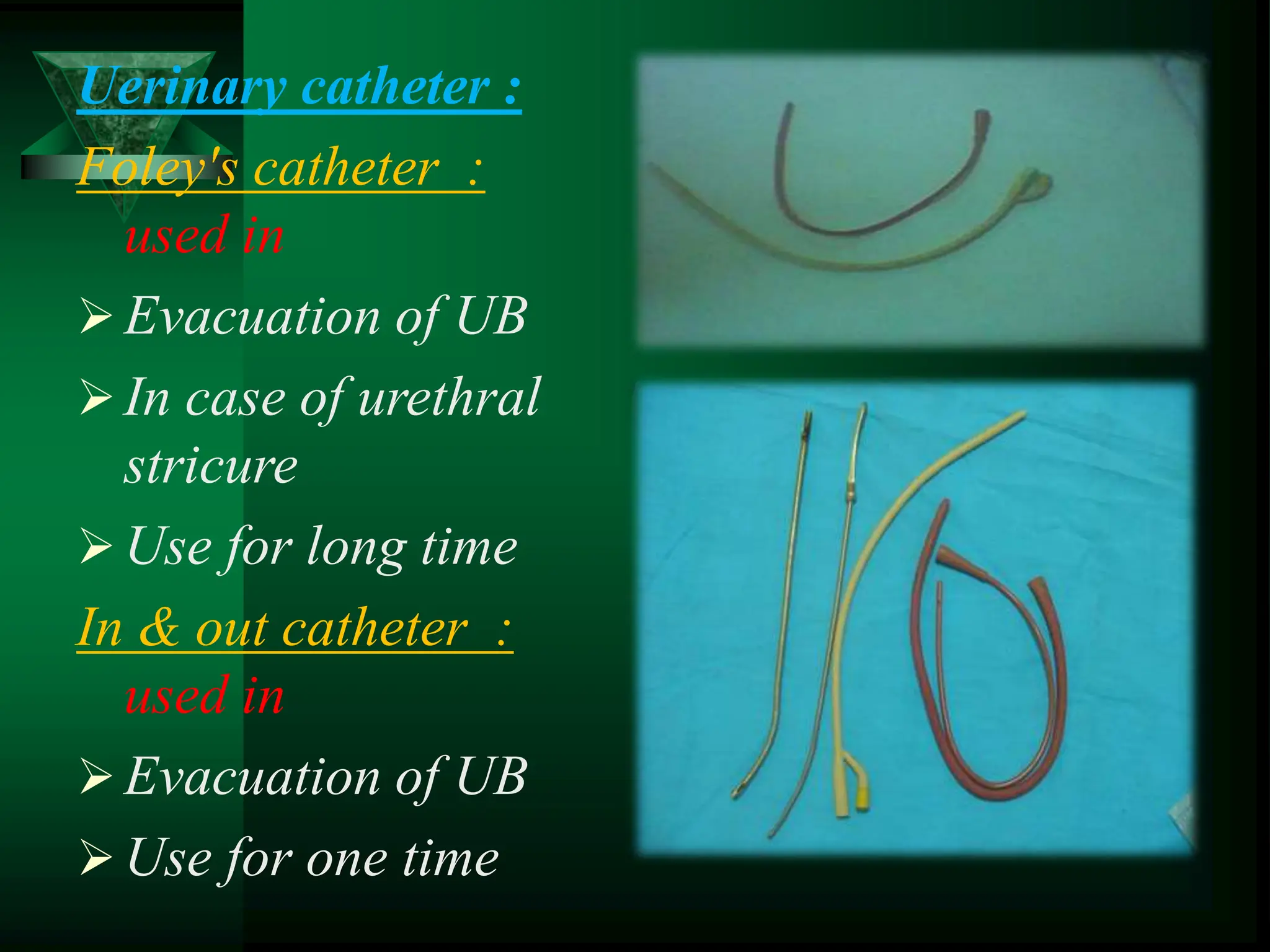 Uerinary catheter :
Foley's catheter :
used in
Evacuation of UB
In case of urethral
stricure
Use for long time
In & out catheter :
used in
Evacuation of UB
Use for one time
 