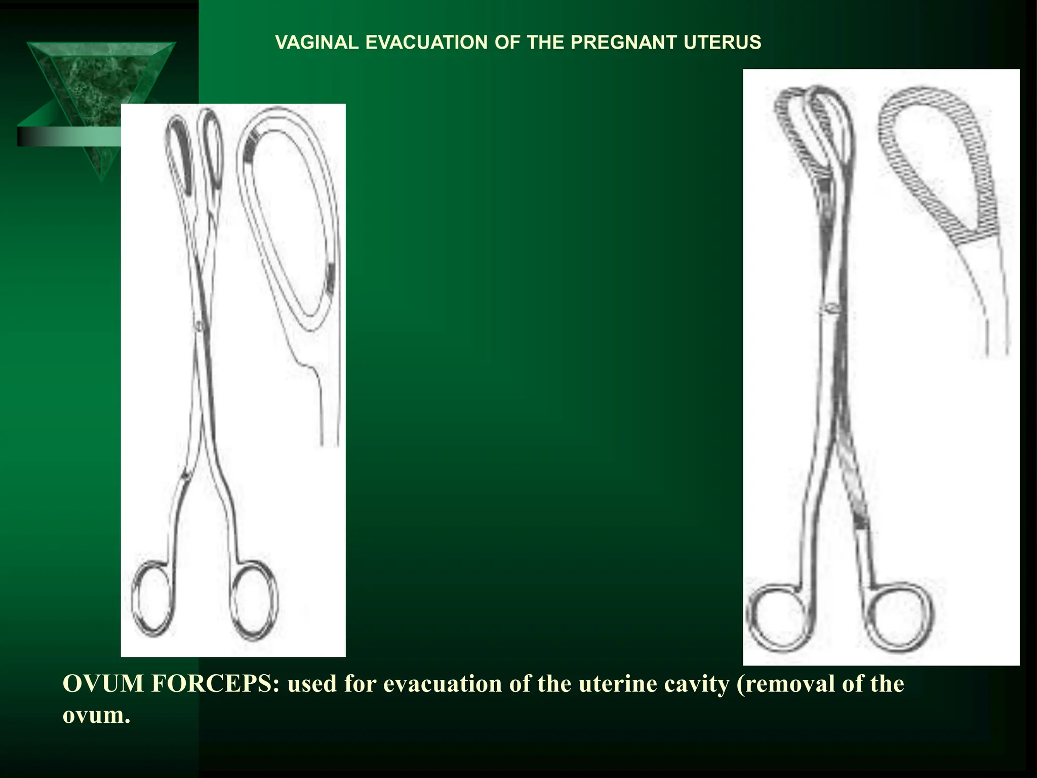 OVUM FORCEPS: used for evacuation of the uterine cavity (removal of the
ovum.
VAGINAL EVACUATION OF THE PREGNANT UTERUS
 