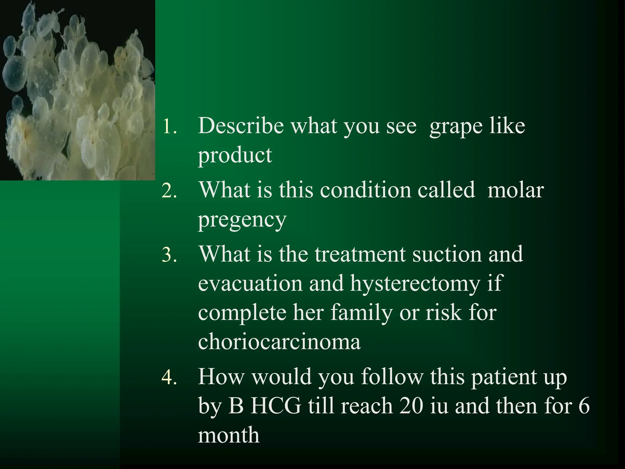 1
1. Describe what you see grape like
product
2. What is this condition called molar
pregency
3. What is the treatment suction and
evacuation and hysterectomy if
complete her family or risk for
choriocarcinoma
4. How would you follow this patient up
by B HCG till reach 20 iu and then for 6
month
 
