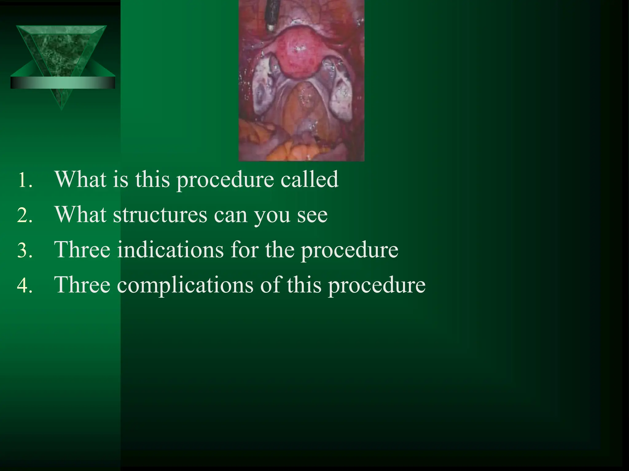 1. What is this procedure called
2. What structures can you see
3. Three indications for the procedure
4. Three complications of this procedure
 