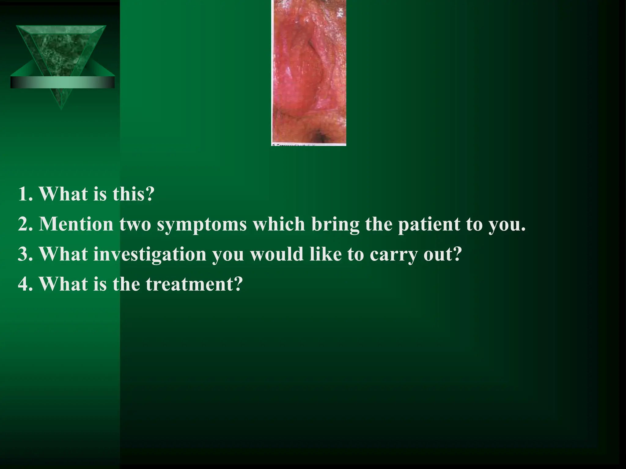 1. What is this?
2. Mention two symptoms which bring the patient to you.
3. What investigation you would like to carry out?
4. What is the treatment?
 