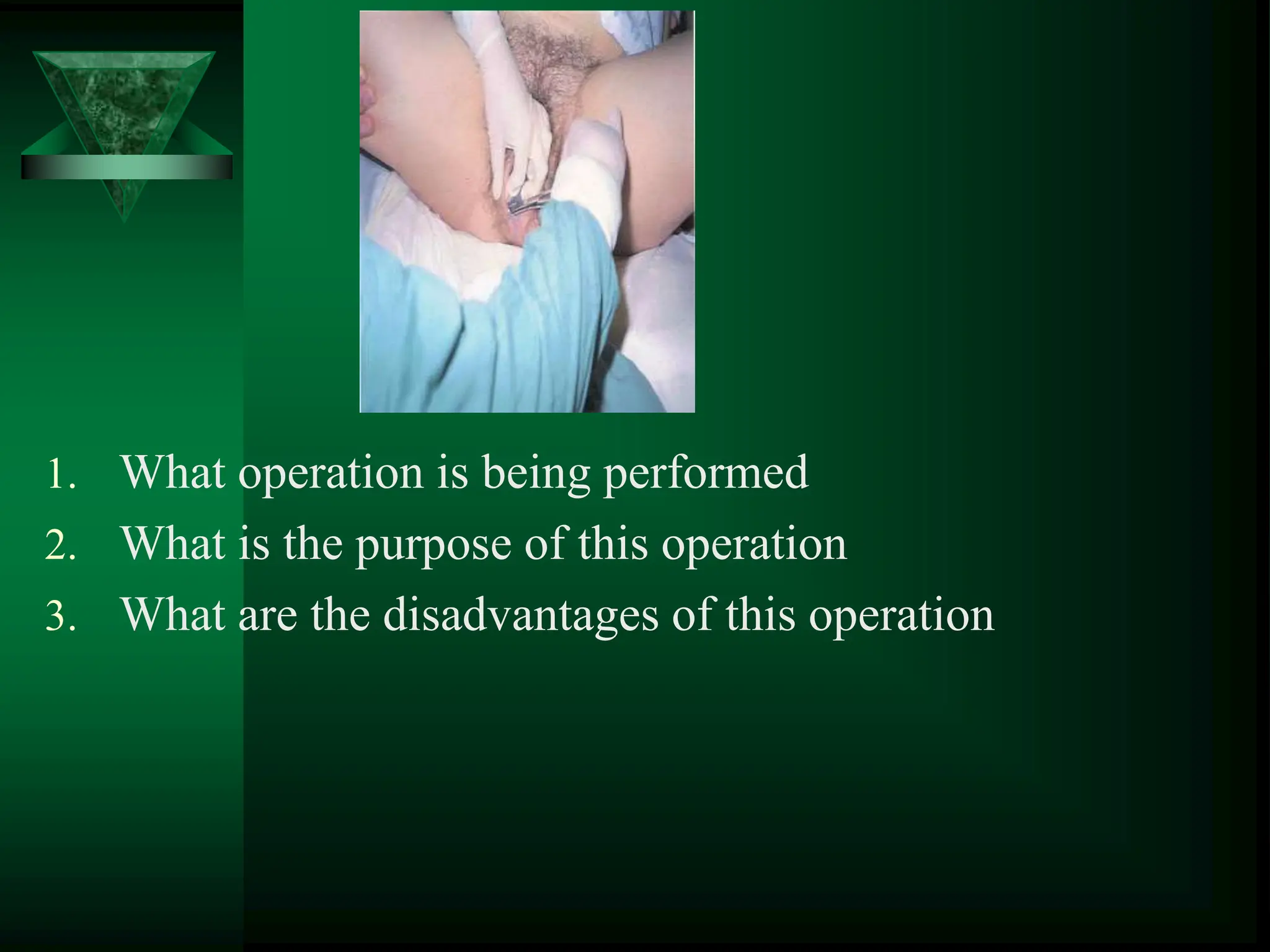1. What operation is being performed
2. What is the purpose of this operation
3. What are the disadvantages of this operation
 