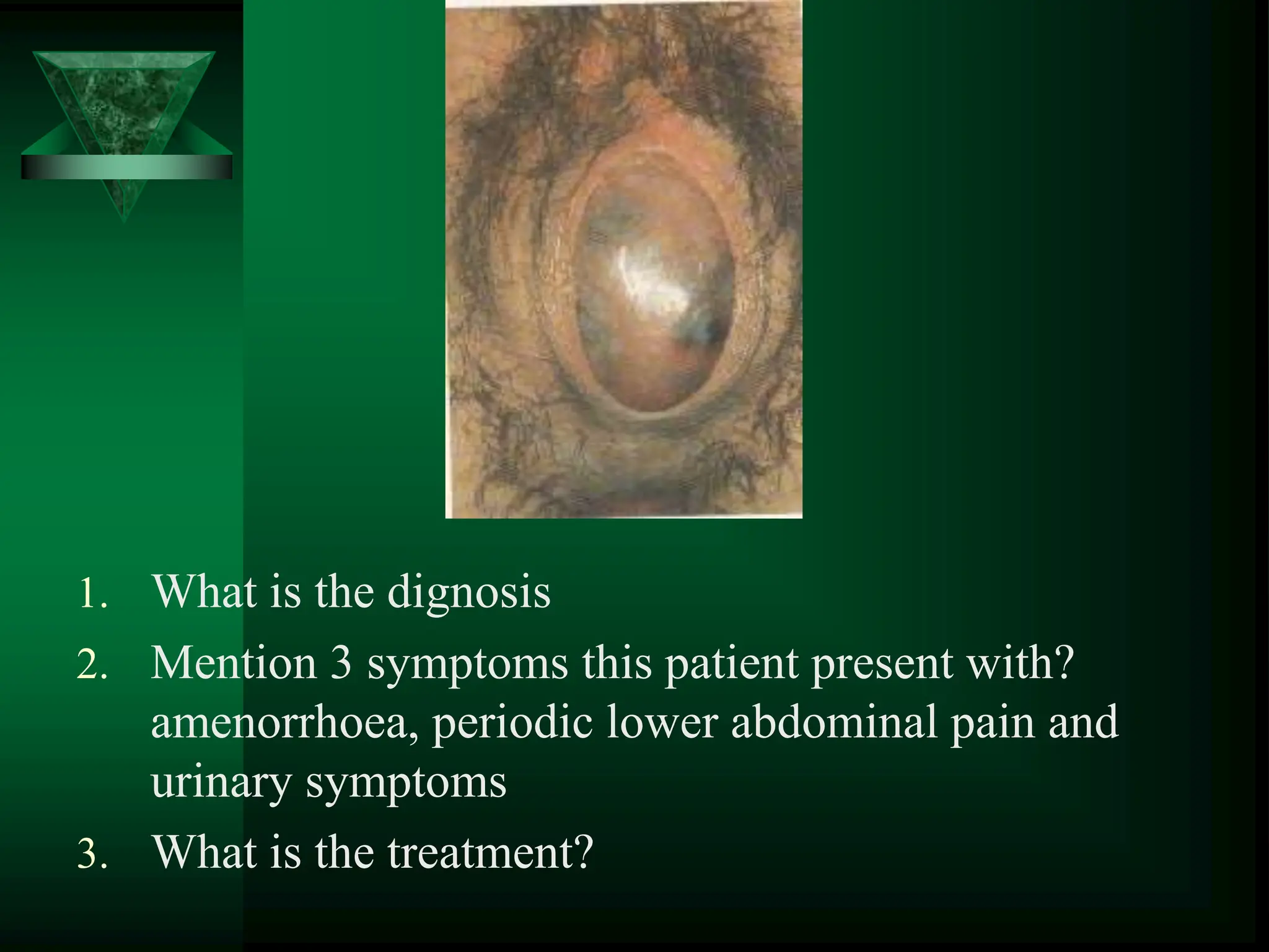 1. What is the dignosis
2. Mention 3 symptoms this patient present with?
amenorrhoea, periodic lower abdominal pain and
urinary symptoms
3. What is the treatment?
 