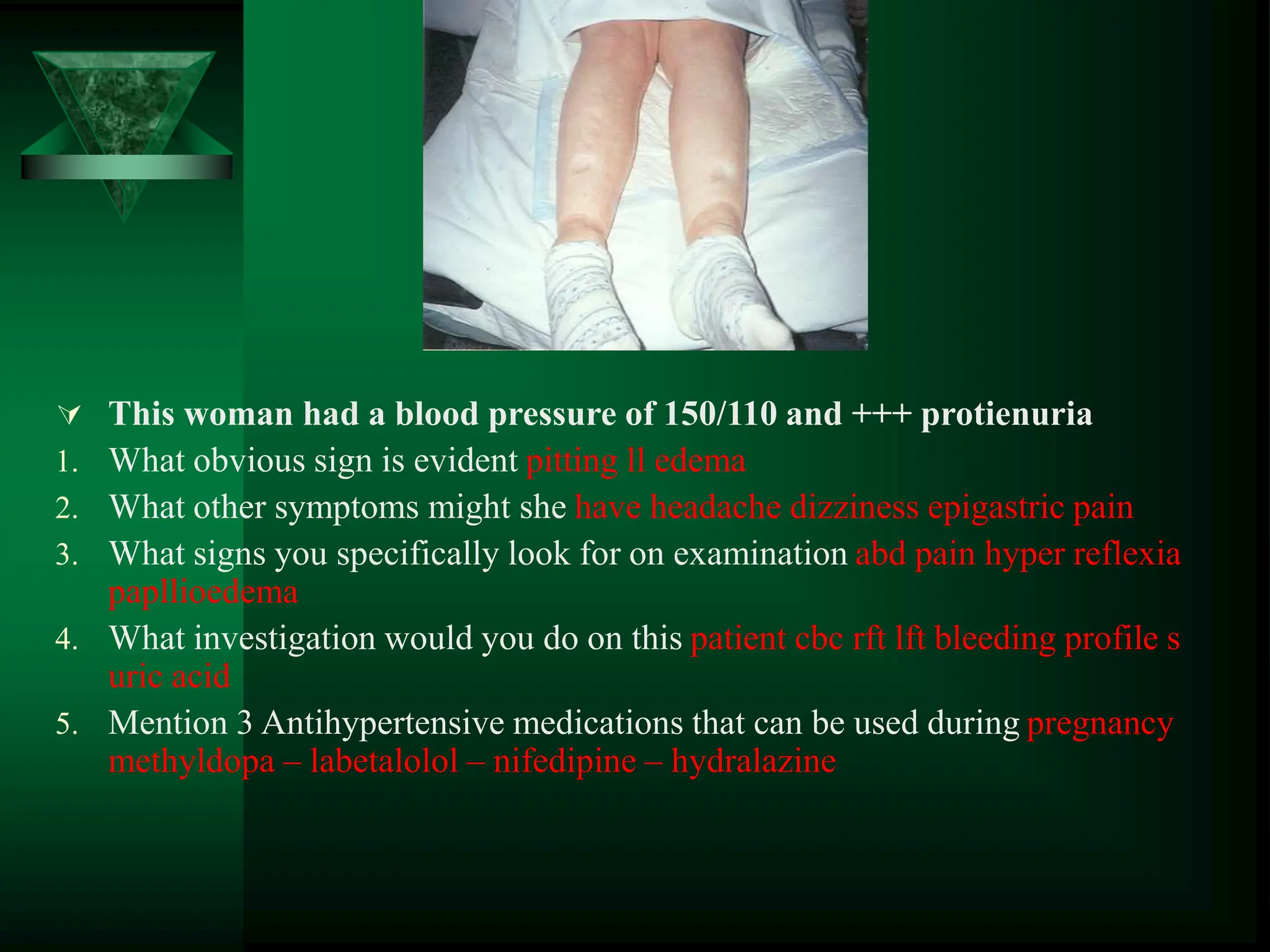  This woman had a blood pressure of 150/110 and +++ protienuria
1. What obvious sign is evident pitting ll edema
2. What other symptoms might she have headache dizziness epigastric pain
3. What signs you specifically look for on examination abd pain hyper reflexia
papllioedema
4. What investigation would you do on this patient cbc rft lft bleeding profile s
uric acid
5. Mention 3 Antihypertensive medications that can be used during pregnancy
methyldopa – labetalolol – nifedipine – hydralazine
 