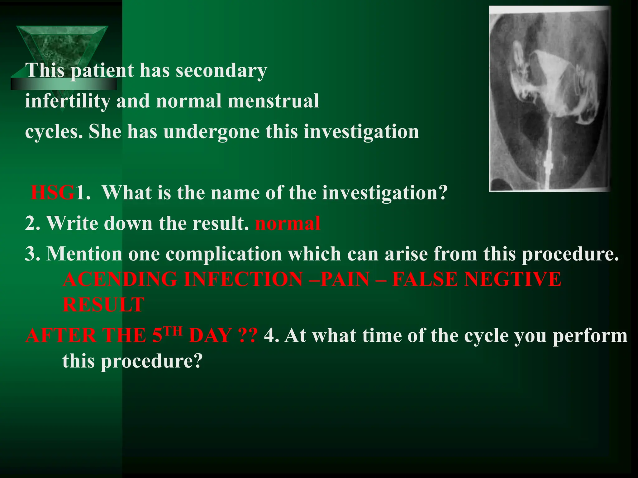 This patient has secondary
infertility and normal menstrual
cycles. She has undergone this investigation
HSG1. What is the name of the investigation?
2. Write down the result. normal
3. Mention one complication which can arise from this procedure.
ACENDING INFECTION –PAIN – FALSE NEGTIVE
RESULT
AFTER THE 5TH DAY ?? 4. At what time of the cycle you perform
this procedure?
 