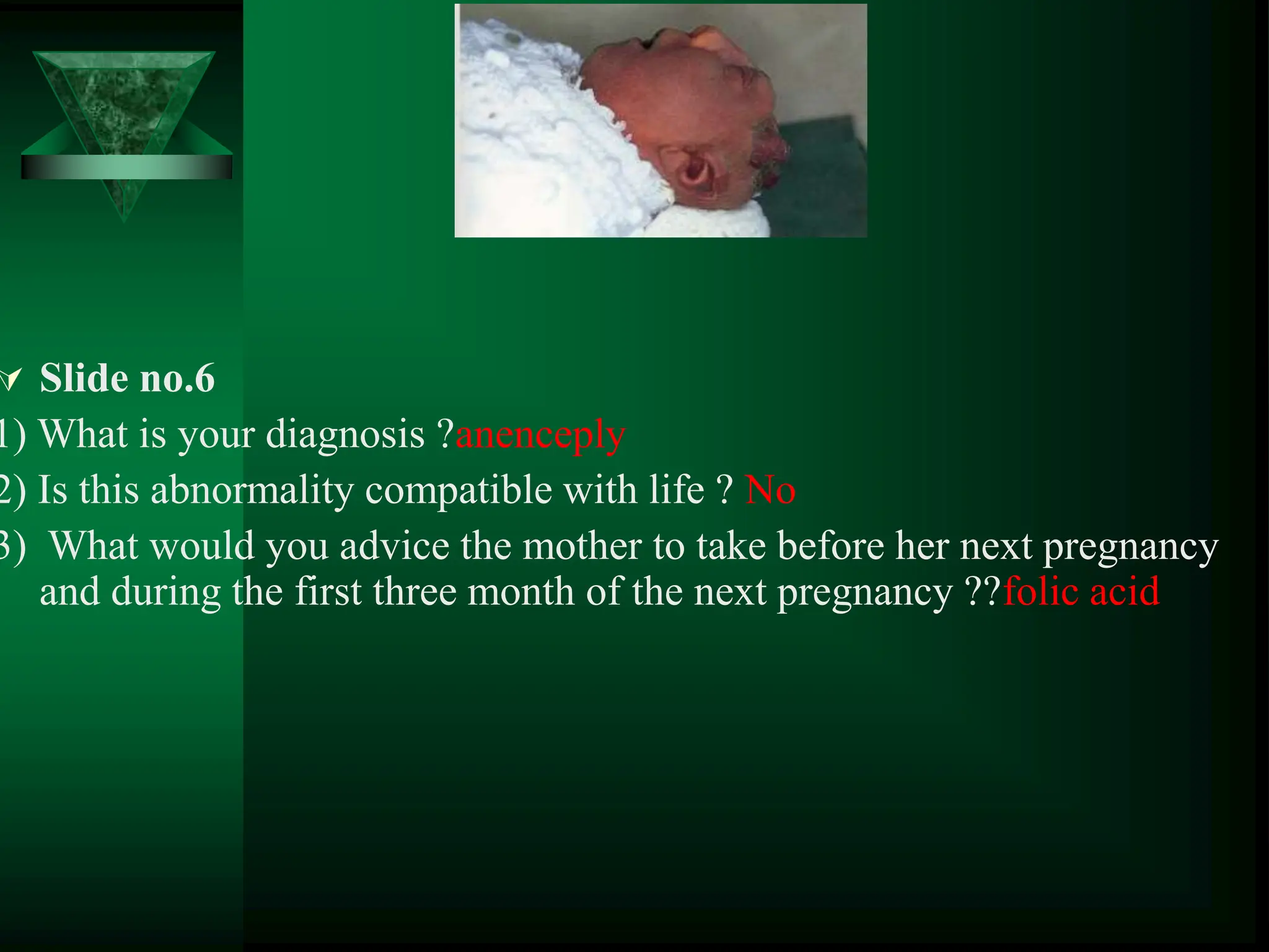  Slide no.6
1) What is your diagnosis ?anenceply
2) Is this abnormality compatible with life ? No
3) What would you advice the mother to take before her next pregnancy
and during the first three month of the next pregnancy ??folic acid
 