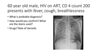 60 year old male, HIV on ART, CD 4 count 200
presents with fever, cough, breathlessness
• What is probable diagnosis?
• How would you confirm? What
are the stains used?
• Drugs? Role of steroids
 