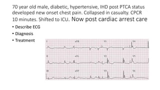 70 year old male, diabetic, hypertensive, IHD post PTCA status
developed new onset chest pain. Collapsed in casualty. CPCR
10 minutes. Shifted to ICU. Now post cardiac arrest care
• Describe ECG
• Diagnosis
• Treatment
 