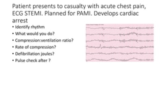 Patient presents to casualty with acute chest pain,
ECG STEMI. Planned for PAMI. Develops cardiac
arrest
• Identify rhythm
• What would you do?
• Compression:ventilation ratio?
• Rate of compression?
• Defibrillation joules?
• Pulse check after ?
 