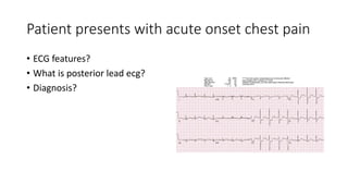 Patient presents with acute onset chest pain
• ECG features?
• What is posterior lead ecg?
• Diagnosis?
 