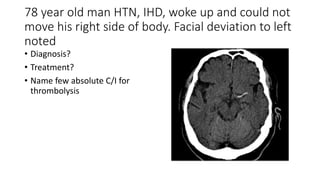 78 year old man HTN, IHD, woke up and could not
move his right side of body. Facial deviation to left
noted
• Diagnosis?
• Treatment?
• Name few absolute C/I for
thrombolysis
 