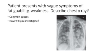Patient presents with vague symptoms of
fatiguability, weakness. Describe chest x ray?
• Common causes
• How will you investigate?
 