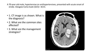 A 70-year-old male, hypertensive on antihypertensives, presented with acute onset of
stroke. Glasgow Coma Scale (GCS)—8/15.
• 1. CT image is as shown. What is
the diagnosis?
• 2. What are the common sites
affected?
• 3. What are the management
strategies?
 