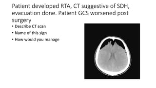 Patient developed RTA, CT suggestive of SDH,
evacuation done. Patient GCS worsened post
surgery
• Describe CT scan
• Name of this sign
• How would you manage
 