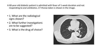 A 68-year-old diabetic patient is admitted with fever of 1-week duration and not
responding to oral antibiotics. CT thorax taken is shown in the image.
• 1. What are the radiological
signs shown?
• 2. What further investigations
are to be suggested?
• 3. What is the drug of choice?
 