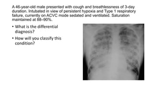 A 46-year-old male presented with cough and breathlessness of 3-day
duration. Intubated in view of persistent hypoxia and Type 1 respiratory
failure, currently on ACVC mode sedated and ventilated. Saturation
maintained at 88–90%.
• What is the differential
diagnosis?
• How will you classify this
condition?
 