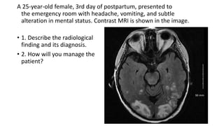 A 25-year-old female, 3rd day of postpartum, presented to
the emergency room with headache, vomiting, and subtle
alteration in mental status. Contrast MRI is shown in the image.
• 1. Describe the radiological
finding and its diagnosis.
• 2. How will you manage the
patient?
 