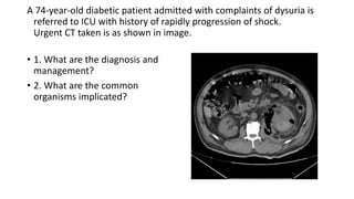 A 74-year-old diabetic patient admitted with complaints of dysuria is
referred to ICU with history of rapidly progression of shock.
Urgent CT taken is as shown in image.
• 1. What are the diagnosis and
management?
• 2. What are the common
organisms implicated?
 