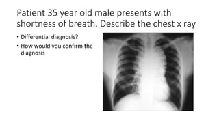 Patient 35 year old male presents with
shortness of breath. Describe the chest x ray
• Differential diagnosis?
• How would you confirm the
diagnosis
 