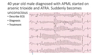 40 year old male diagnosed with APML started on
arsenic trioxide and ATRA. Suddenly becomes
unconscious
• Describe ECG
• Diagnosis
• Treatment
 
