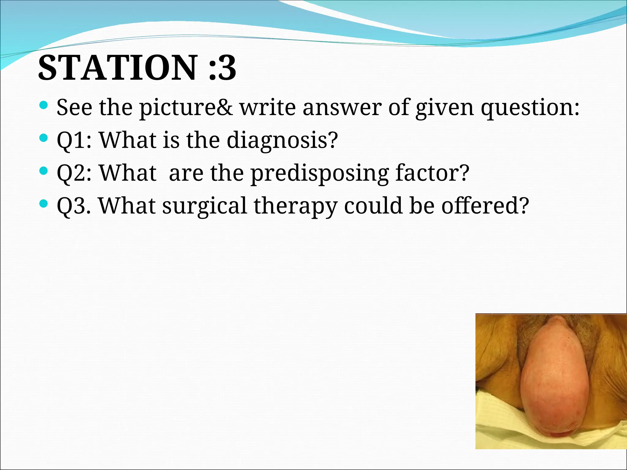 STATION :3
 See the picture& write answer of given question:
 Q1: What is the diagnosis?
 Q2: What are the predisposing factor?
 Q3. What surgical therapy could be offered?
 
