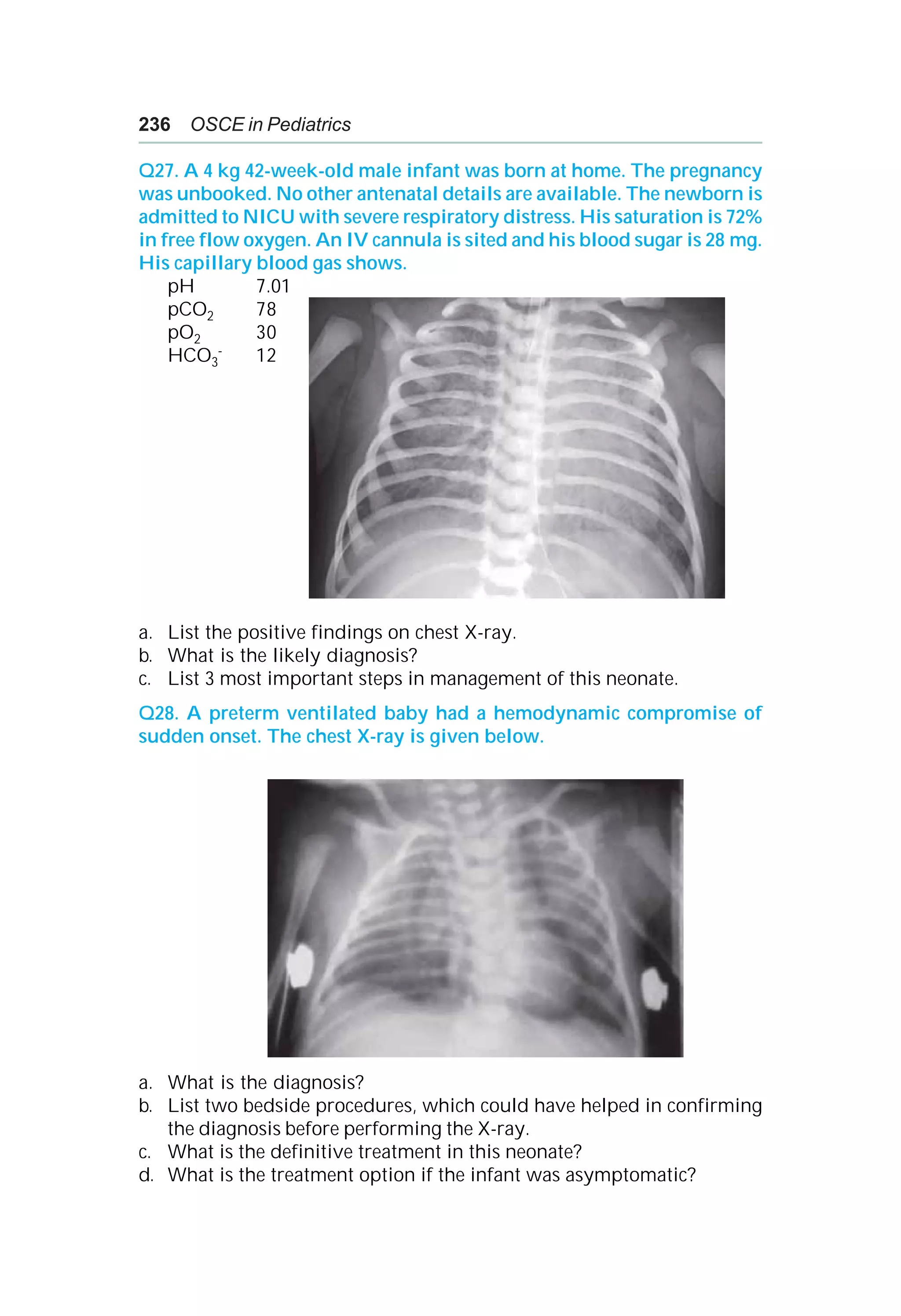 Osce Home.pdf Osce in pediatrics | PDF