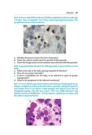 Infection 97
Q15. A 8-year-old child resident of Delhi is admitted with fever for last
5-6 days, loss of appetite for 6 days and hepatosplenomegaly. His
peripheral smear is shown below.
a. Identify the picture (name the form of parasite).
b. Name the culture media used for growth of this parasite.
c. Name the drugs used to treat resistant cases infected with this parasite.
Q16. A pregnant lady found to be HBsAg positive, gives birth to a term
baby.
a. What is the risk of the baby getting hepatitis B infection?
b. How do you protect the baby?
c. Is there a possibility for the baby to be infected in spite of proper
management?
d. What is the prognosis in the infected newborns?
Q17. A 7-year-old boy presented with 4 weeks history of high grade fever,
fatigue, weight loss and was found to have a grossly enlarged relatively
non tender liver 4 cm below costal margin and spleen 6 cm but no
lymphadenopathy. His Hb was 4 gm%, TLC was 3500 cells/mm3
and
platelet counts of 56,000 mm3
. A bone marrow aspiration was done and
the slide is depicted below.
 
