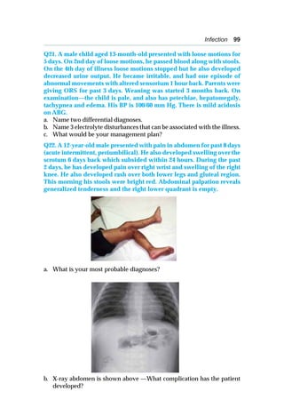 Infection 99
Q21. A male child aged 13-month-old presented with loose motions for
5 days. On 2nd day of loose motions, he passed blood along with stools.
On the 4th day of illness loose motions stopped but he also developed
decreased urine output. He became irritable, and had one episode of
abnormal movements with altered sensorium 1 hour back. Parents were
giving ORS for past 3 days. Weaning was started 3 months back. On
examination—the child is pale, and also has petechiae, hepatomegaly,
tachypnea and edema. His BP is 100/60 mm Hg. There is mild acidosis
on ABG.
a. Name two differential diagnoses.
b. Name 3 electrolyte disturbances that can be associated with the illness.
c. What would be your management plan?
Q22. A 12-year-old male presented with pain in abdomen for past 8 days
(acute intermittent, periumbilical). He also developed swelling over the
scrotum 6 days back which subsided within 24 hours. During the past
2 days, he has developed pain over right wrist and swelling of the right
knee. He also developed rash over both lower legs and gluteal region.
This morning his stools were bright red. Abdominal palpation reveals
generalized tenderness and the right lower quadrant is empty.
a. What is your most probable diagnoses?
b. X-ray abdomen is shown above —What complication has the patient
developed?
 