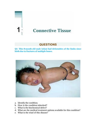 QUESTIONS
Q1. This 8-month-old male infant had deformities of the limbs since
birth due to fractures of multiple bones.
a. Identify the condition.
b. How is the condition inherited?
c. What is the biochemical defect?
d. What are the medical treatment options available for this condition?
e. What is the triad of this disease?
Connective Tissue1
 
