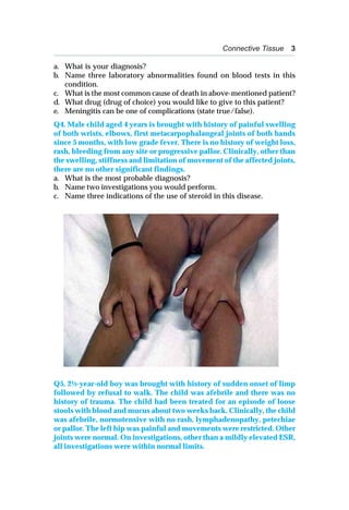 Connective Tissue 3
a. What is your diagnosis?
b. Name three laboratory abnormalities found on blood tests in this
condition.
c. What is the most common cause of death in above-mentioned patient?
d. What drug (drug of choice) you would like to give to this patient?
e. Meningitis can be one of complications (state true/false).
Q4. Male child aged 4 years is brought with history of painful swelling
of both wrists, elbows, first metacarpophalangeal joints of both hands
since 5 months, with low grade fever. There is no history of weight loss,
rash, bleeding from any site or progressive pallor. Clinically, other than
the swelling, stiffness and limitation of movement of the affected joints,
there are no other significant findings.
a. What is the most probable diagnosis?
b. Name two investigations you would perform.
c. Name three indications of the use of steroid in this disease.
Q5. 2½-year-old boy was brought with history of sudden onset of limp
followed by refusal to walk. The child was afebrile and there was no
history of trauma. The child had been treated for an episode of loose
stools with blood and mucus about two weeks back. Clinically, the child
was afebrile, normotensive with no rash, lymphadenopathy, petechiae
or pallor. The left hip was painful and movements were restricted. Other
joints were normal. On investigations, other than a mildly elevated ESR,
all investigations were within normal limits.
 