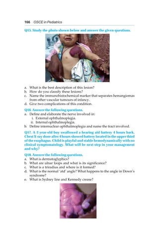 166 OSCE in Pediatrics
Q15. Study the photo shown below and answer the given questions.
a. What is the best description of this lesion?
b. How do you classify these lesions?
c. Name the immunohistochemical marker that separates hemangiomas
from other vascular tumours of infancy.
d. Give two complications of this condition.
Q16. Answer the following questions.
a. Define and elaborate the nerve involved in:
i. External ophthalmoplegia.
ii. Internal ophthalmoplegia.
b. Define internuclear ophthalmoplegia and name the tract involved.
Q17. A 2-year-old boy swallowed a hearing aid battery 4 hours back.
Chest X-ray done after 4 hours showed battery located in the upper third
of the esophagus. Child is playful and stable hemodynamically with no
clinical symptomatology. What will be next step in your management
and why?
Q18. Answer the following questions.
a. What is dermatoglyphics?
b. What are ulnar loops and what is its significance?
c. What is a triradius and where is it formed?
d. What is the normal ‘atd’ angle? What happens to the angle in Down’s
syndrome?
e. What is Sydney line and Kennedy crease?
 