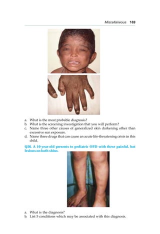 Miscellaneous 169
a. What is the most probable diagnosis?
b. What is the screening investigation that you will perform?
c. Name three other causes of generalized skin darkening other than
excessive sun exposure.
d. Name three drugs that can cause an acute life-threatening crisis in this
child.
Q26. A 10-year-old presents to pediatric OPD with these painful, hot
lesions on both shins.
a. What is the diagnosis?
b. List 5 conditions which may be associated with this diagnosis.
 