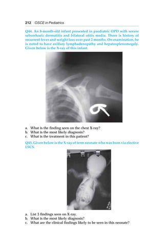 212 OSCE in Pediatrics
Q44. An 8-month-old infant presented in paediatric OPD with severe
seborrhoeic dermatitis and bilateral otitis media. There is history of
recurrent fever and weight loss over past 2 months. On examination, he
is noted to have axillary lymphadenopathy and hepatosplenomegaly.
Given below is the X-ray of this infant.
a. What is the finding seen on the chest X-ray?
b. What is the most likely diagnosis?
c. What is the treatment in this patient?
Q45. Given below is the X-ray of term neonate who was born via elective
LSCS.
a. List 3 findings seen on X-ray.
b. What is the most likely diagnosis?
c. What are the clinical findings likely to be seen in this neonate?
 