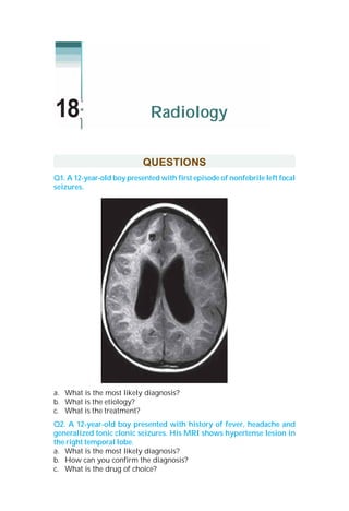 QUESTIONS
Q1. A 12-year-old boy presented with first episode of nonfebrile left focal
seizures.
a. What is the most likely diagnosis?
b. What is the etiology?
c. What is the treatment?
Q2. A 12-year-old boy presented with history of fever, headache and
generalized tonic clonic seizures. His MRI shows hypertense lesion in
the right temporal lobe.
a. What is the most likely diagnosis?
b. How can you confirm the diagnosis?
c. What is the drug of choice?
Radiology18
 