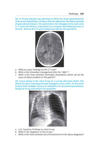 Radiology 225
Q4. A 10-year-old girl was admitted in PICU for Acute gastroenteritis
with severe dehydration. 24 hours after the admission she had an episode
of generalized seizures. On examination, her Glasgow coma scale score
is 7, heart rate 60/min, respirations are irregular and blood pressure is
normal. Review the CT given below and answer the questions.
a. What are your findings on the CT scan?
b. What is the immediate management after the “ABC”?
c. What is the most common electrolyte disturbance which can be the
cause of above problem in this patient?
Q5. Given below is the chest X-ray of a 6-week-old male infant. The
infant has been having persistent tachypnea since birth. He has been
treated with multiple courses of antibiotics for presumed pneumonia.
Study the X-ray and answer the questions.
a. List 3 positive findings on chest X-ray.
b. What is the diagnosis in this X-ray?
c. What is the most common site of involvement in the above diagnosis?
 