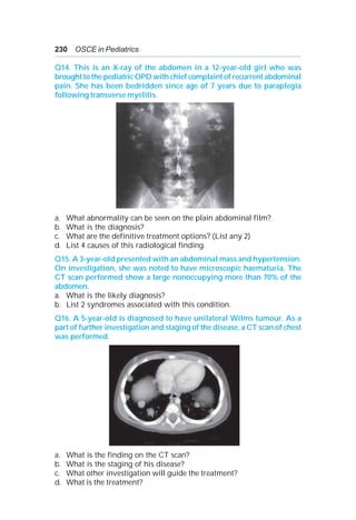 230 OSCE in Pediatrics
Q14. This is an X-ray of the abdomen in a 12-year-old girl who was
brought to the pediatric OPD with chief complaint of recurrent abdominal
pain. She has been bedridden since age of 7 years due to paraplegia
following transverse myelitis.
a. What abnormality can be seen on the plain abdominal film?
b. What is the diagnosis?
c. What are the definitive treatment options? (List any 2)
d. List 4 causes of this radiological finding.
Q15. A 3-year-old presented with an abdominal mass and hypertension.
On investigation, she was noted to have microscopic haematuria. The
CT scan performed show a large nonoccupying more than 70% of the
abdomen.
a. What is the likely diagnosis?
b. List 2 syndromes associated with this condition.
Q16. A 5-year-old is diagnosed to have unilateral Wilms tumour. As a
part of further investigation and staging of the disease, a CT scan of chest
was performed.
a. What is the finding on the CT scan?
b. What is the staging of his disease?
c. What other investigation will guide the treatment?
d. What is the treatment?
 