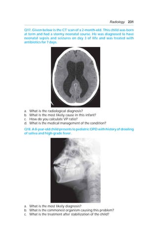 Radiology 231
Q17. Given below is the CT scan of a 2-month-old. This child was born
at term and had a stormy neonatal course. He was diagnosed to have
neonatal sepsis and seizures on day 3 of life and was treated with
antibiotics for 7 days.
a. What is the radiological diagnosis?
b. What is the most likely cause in this infant?
c. How do you calculate VP ratio?
d. What is the medical management of the condition?
Q18. A 8-year-old child presents to pediatric OPD with history of drooling
of saliva and high-grade fever.
a. What is the most likely diagnosis?
b. What is the commonest organism causing this problem?
c. What is the treatment after stabilization of the child?
 