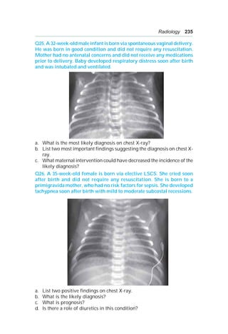 Radiology 235
Q25. A 32-week-old male infant is born via spontaneous vaginal delivery.
He was born in good condition and did not require any resuscitation.
Mother had no antenatal concerns and did not receive any medications
prior to delivery. Baby developed respiratory distress soon after birth
and was intubated and ventilated.
a. What is the most likely diagnosis on chest X-ray?
b. List two most important findings suggesting the diagnosis on chest X-
ray.
c. What maternal intervention could have decreased the incidence of the
likely diagnosis?
Q26. A 35-week-old female is born via elective LSCS. She cried soon
after birth and did not require any resuscitation. She is born to a
primigravida mother, who had no risk factors for sepsis. She developed
tachypnea soon after birth with mild to moderate subcostal recessions.
a. List two positive findings on chest X-ray.
b. What is the likely diagnosis?
c. What is prognosis?
d. Is there a role of diuretics in this condition?
 