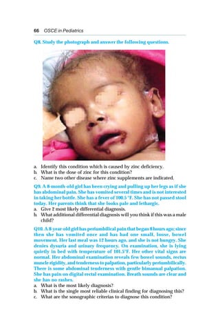 66 OSCE in Pediatrics
Q8. Study the photograph and answer the following questions.
a. Identify this condition which is caused by zinc deficiency.
b. What is the dose of zinc for this condition?
c. Name two other disease where zinc supplements are indicated.
Q9. A 8-month-old girl has been crying and pulling up her legs as if she
has abdominal pain. She has vomited several times and is not interested
in taking her bottle. She has a fever of 100.5 °F. She has not passed stool
today. Her parents think that she looks pale and lethargic.
a. Give 2 most likely differential diagnosis.
b. What additional differential diagnosis will you think if this was a male
child?
Q10. A 8-year-old girl has periumbilical pain that began 8 hours ago; since
then she has vomited once and has had one small, loose, bowel
movement. Her last meal was 12 hours ago, and she is not hungry. She
denies dysuria and urinary frequency. On examination, she is lying
quietly in bed with temperature of 101.5°F. Her other vital signs are
normal. Her abdominal examination reveals few bowel sounds, rectus
muscle rigidity, and tenderness to palpation, particularly periumbilically.
There is some abdominal tenderness with gentle bimanual palpation.
She has pain on digital rectal examination. Breath sounds are clear and
she has no rashes.
a. What is the most likely diagnosis?
b. What is the single most reliable clinical finding for diagnosing this?
c. What are the sonographic criterias to diagnose this condition?
 