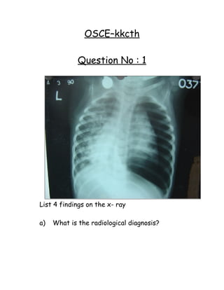 OSCE–kkcth

             Question No : 1




List 4 findings on the x- ray

a)   What is the radiological diagnosis?
 
