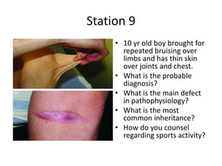 Station 9
• 10 yr old boy brought for
repeated bruising over
limbs and has thin skin
over joints and chest.
• What is the probable
diagnosis?
• What is the main defect
in pathophysiology?
• What is the most
common inheritance?
• How do you counsel
regarding sports activity?
 