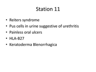 Station 11
• Reiters syndrome
• Pus cells in urine suggestive of urethritis
• Painless oral ulcers
• HLA-B27
• Keratoderma Blenorrhagica
 