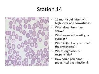 Station 14
• 11 month old infant with
high fever and convulsions
• What does the smear
show?
• What association will you
suspect?
• What is the likely cause of
the symptoms?
• Which organism is
responsible?
• How could you have
prevented the infection?
 