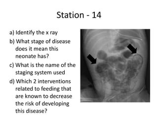 Station - 14
a) Identify the x ray
b) What stage of disease
does it mean this
neonate has?
c) What is the name of the
staging system used
d) Which 2 interventions
related to feeding that
are known to decrease
the risk of developing
this disease?
 