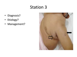 Station 3
• Diagnosis?
• Etiology?
• Management?
 