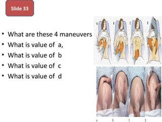 • What are these 4 maneuvers
• What is value of a,
• What is value of b
• What is value of c
• What is value of d
Slide 33
 