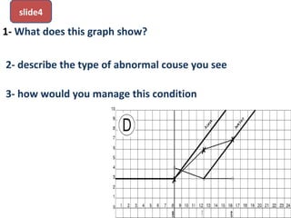 1- What does this graph show?
2- describe the type of abnormal couse you see
3- how would you manage this condition
.
slide4
 