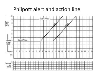 Philpott alert and action line
 