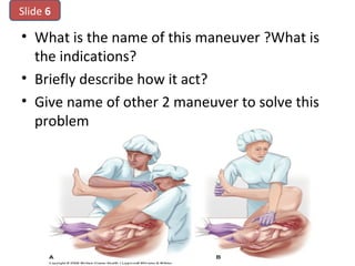• What is the name of this maneuver ?What is
the indications?
• Briefly describe how it act?
• Give name of other 2 maneuver to solve this
problem
Slide 6
 