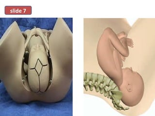 • determine
slide 7
 